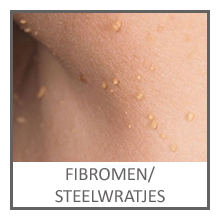 Fibromen/Steelwratjes